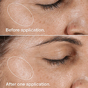Clinique Clarifying Lotion Arındırıcı Losyon 200 Ml 2 - 2