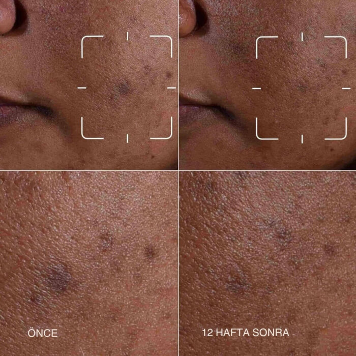 Clinique Even Better Dark Spot Serum 30 Ml - 3