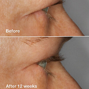 Clinique High Impact Lash Amplifying Serum - 4