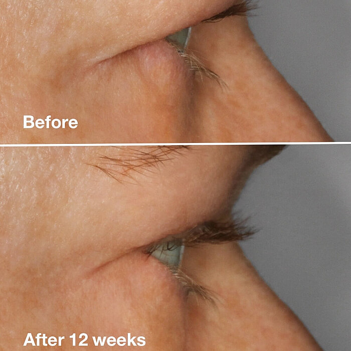 Clinique High Impact Lash Amplifying Serum - 4