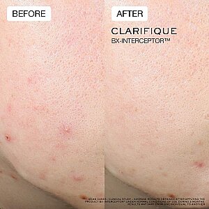Lancome Clarifique BX-Interceptor Serum 30 Ml - 5