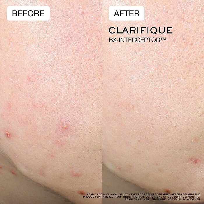 Lancome Clarifique BX-Interceptor Serum 30 Ml - 5