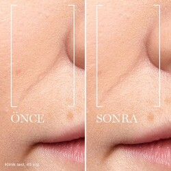 Lancome Renergie Multi Lift Ultra Triple Serum 50 Ml - 5