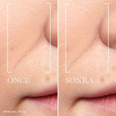 Lancome Renergie Multi Lift Ultra Triple Serum 50 Ml - 5