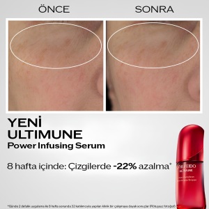 Shiseido Ultimune Power Infusing Concentrate Serum 75 Ml - 5